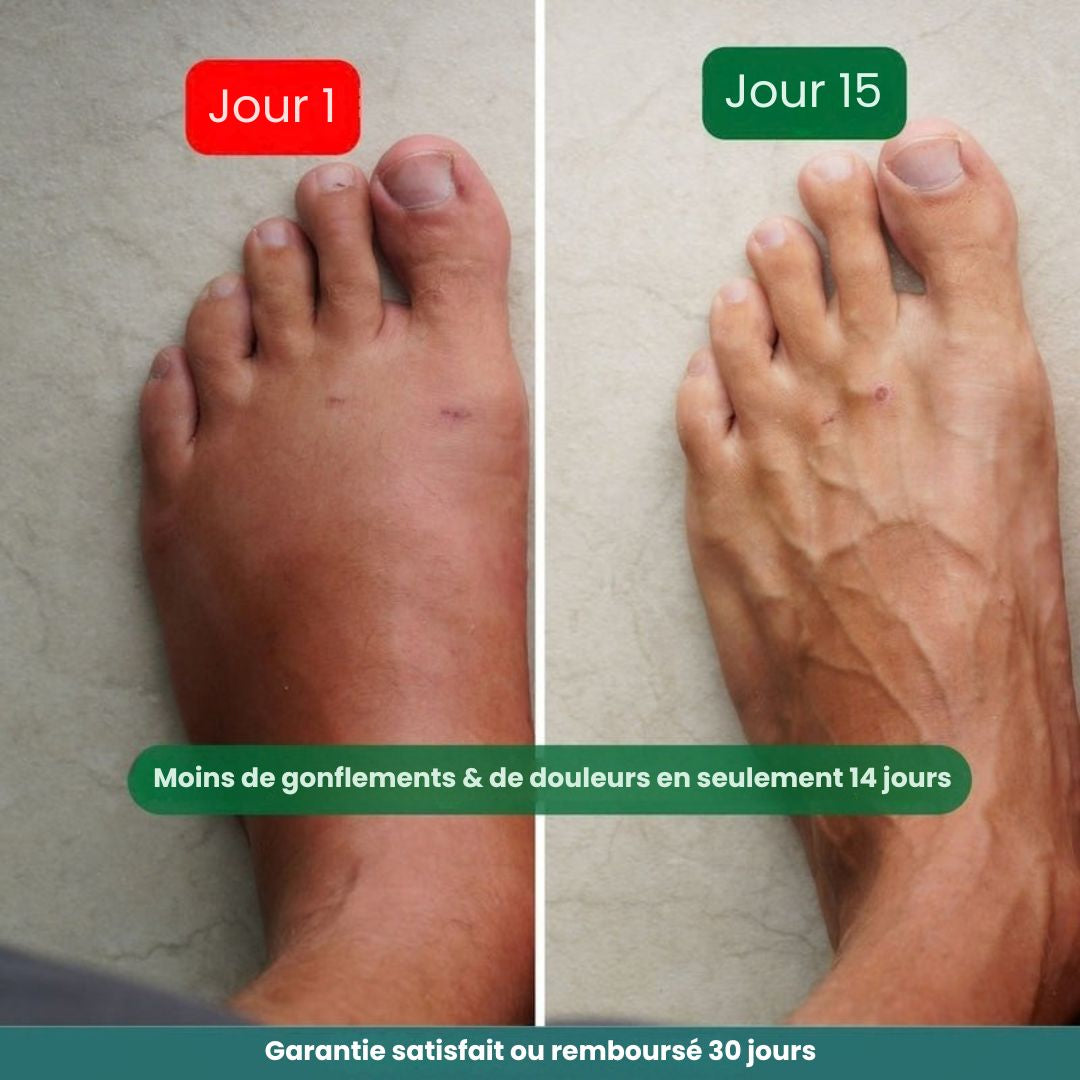 Bas de contention NivaLeg® pour jambes lourdes et douloureuses