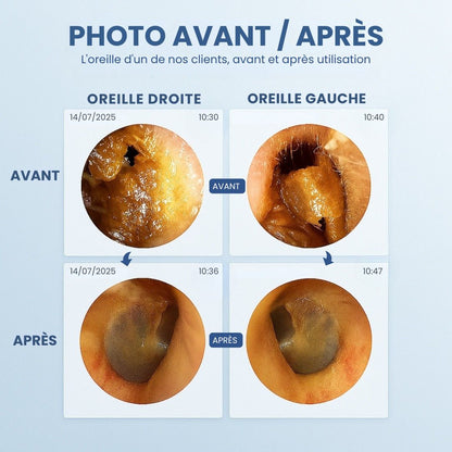 Nettoyeur oreilles avec caméra
