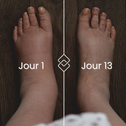Bas de contention NivaLeg® pour jambes lourdes et douloureuses