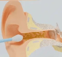 Nettoyeur oreilles avec caméra
